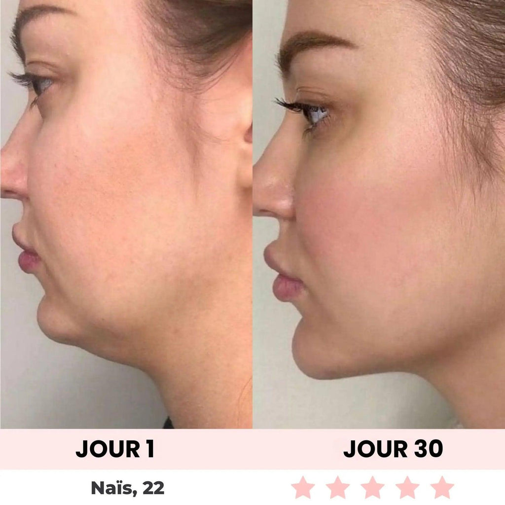 Double Chin Reducer Mask – Get a Sharper Jawline at Home